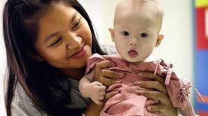 Madre de alquiler adopta a un mellizo con síndrome de Down que rechazó su madre biológica